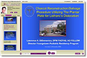 Charcot Reconstruction