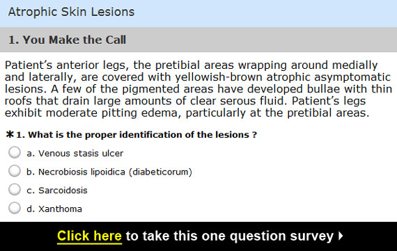 atrophic skin survey