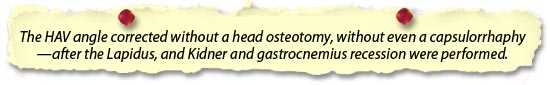 The HAV angle corrected without a head osteotomy