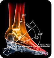 What Happened to American Podiatric Biomechanics