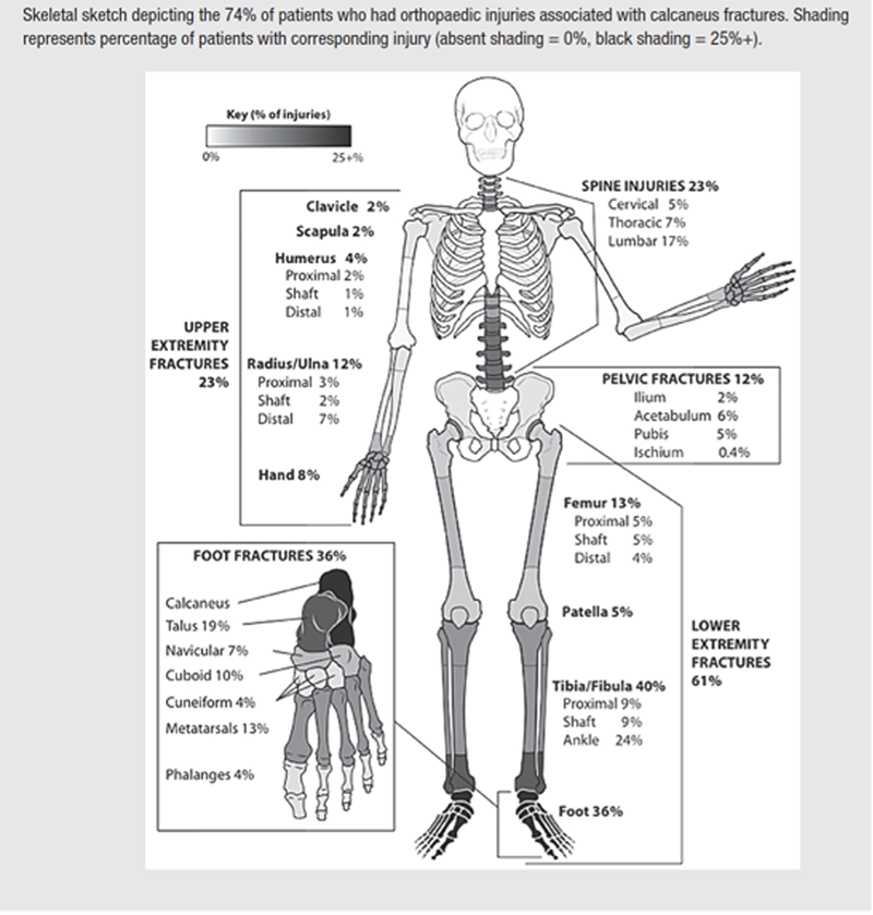 Practice Perfect 796 - More About Calcaneal Fractures