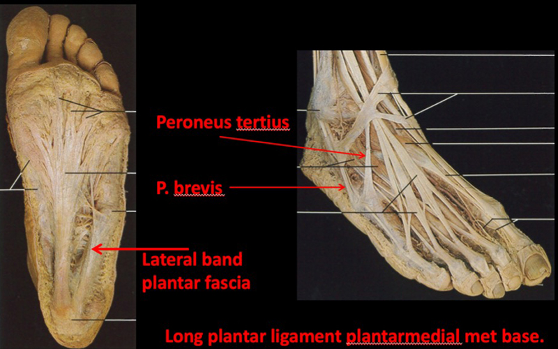 Anatomy of the plantar aspect of the foot demonstrating the bands of